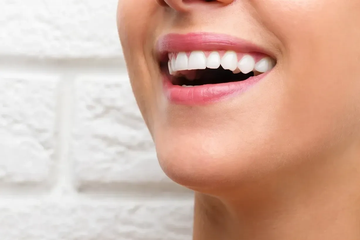 What is Tooth Shaping (Contouring)?