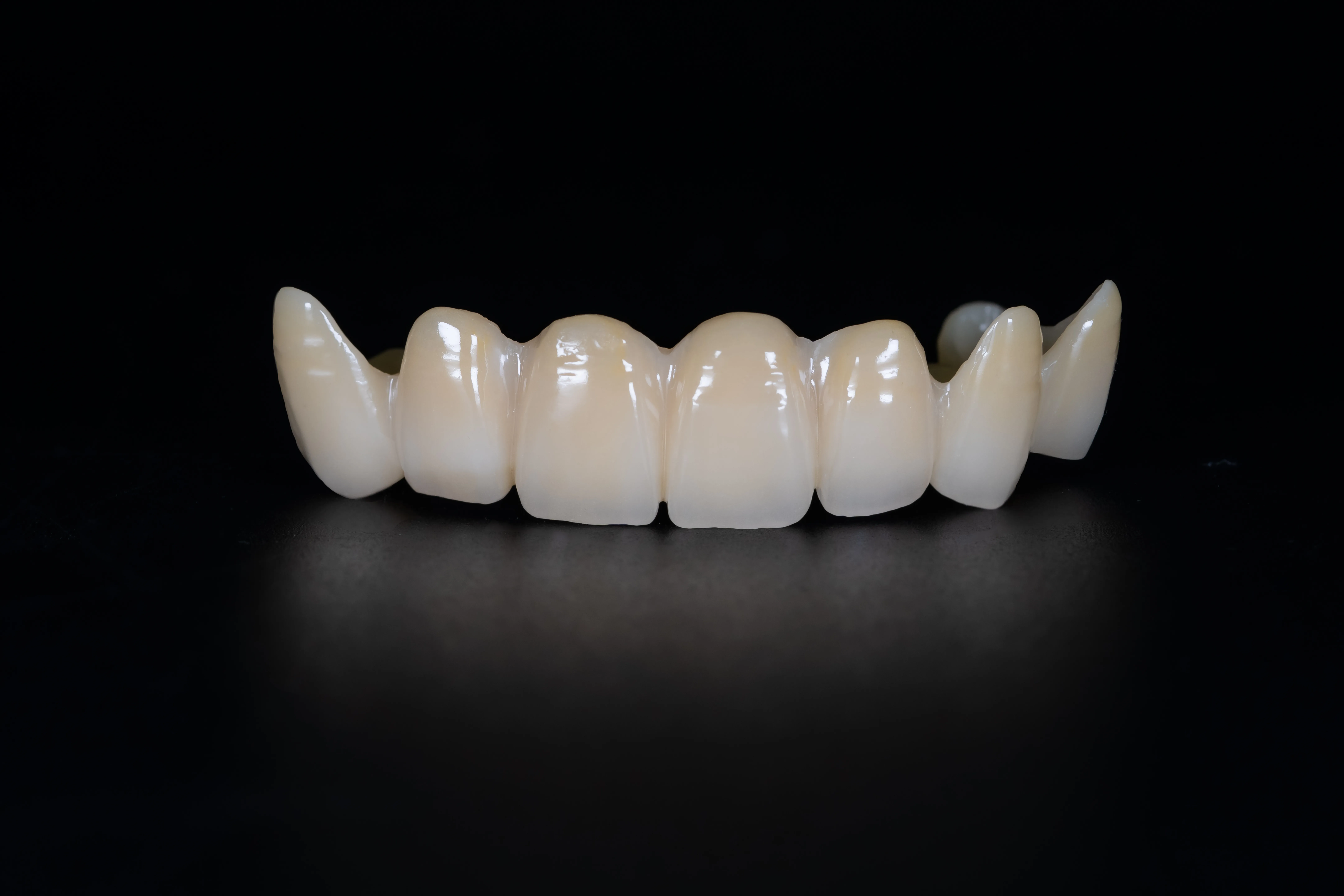 porcelein crown
