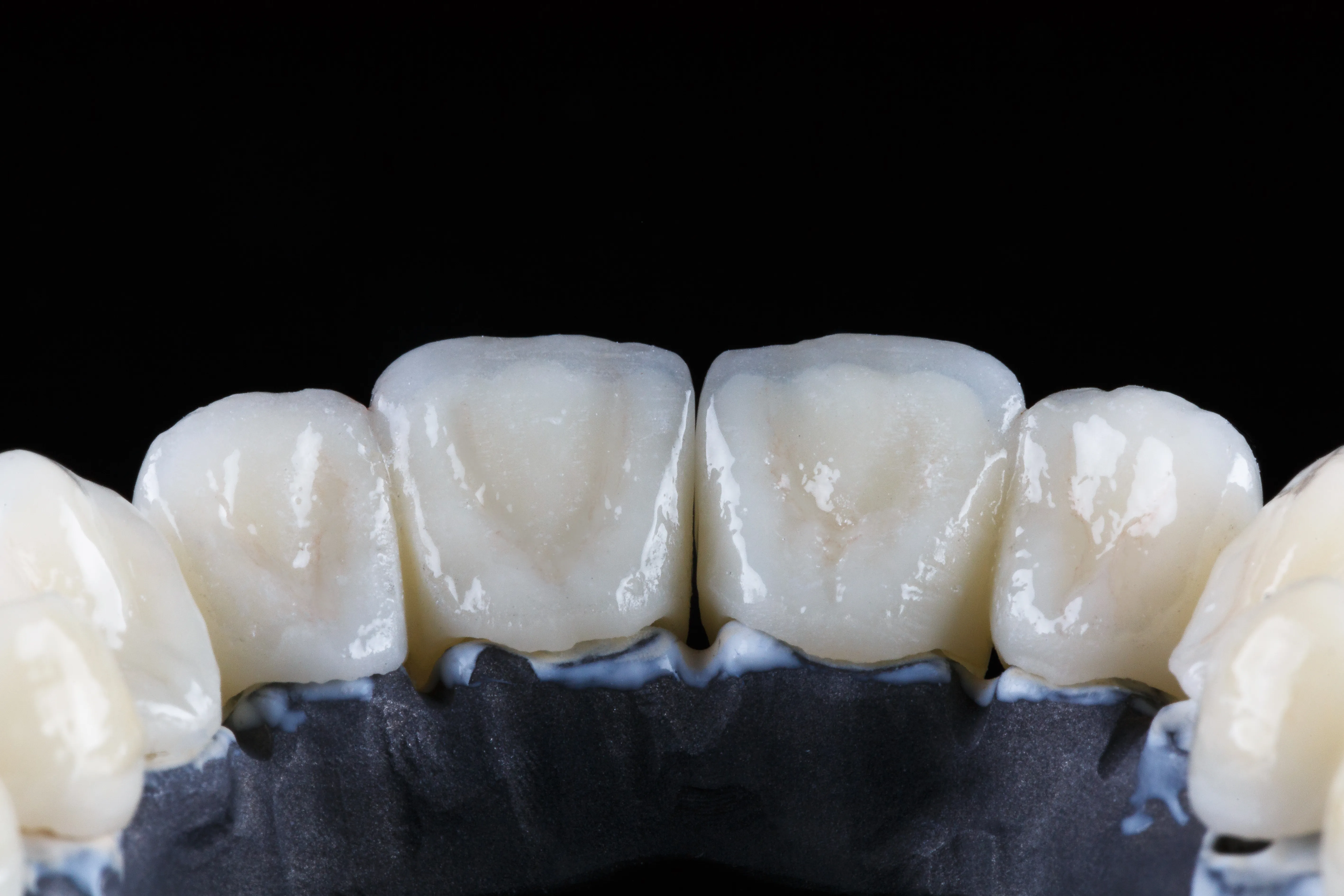 Zirconium Dental Crown