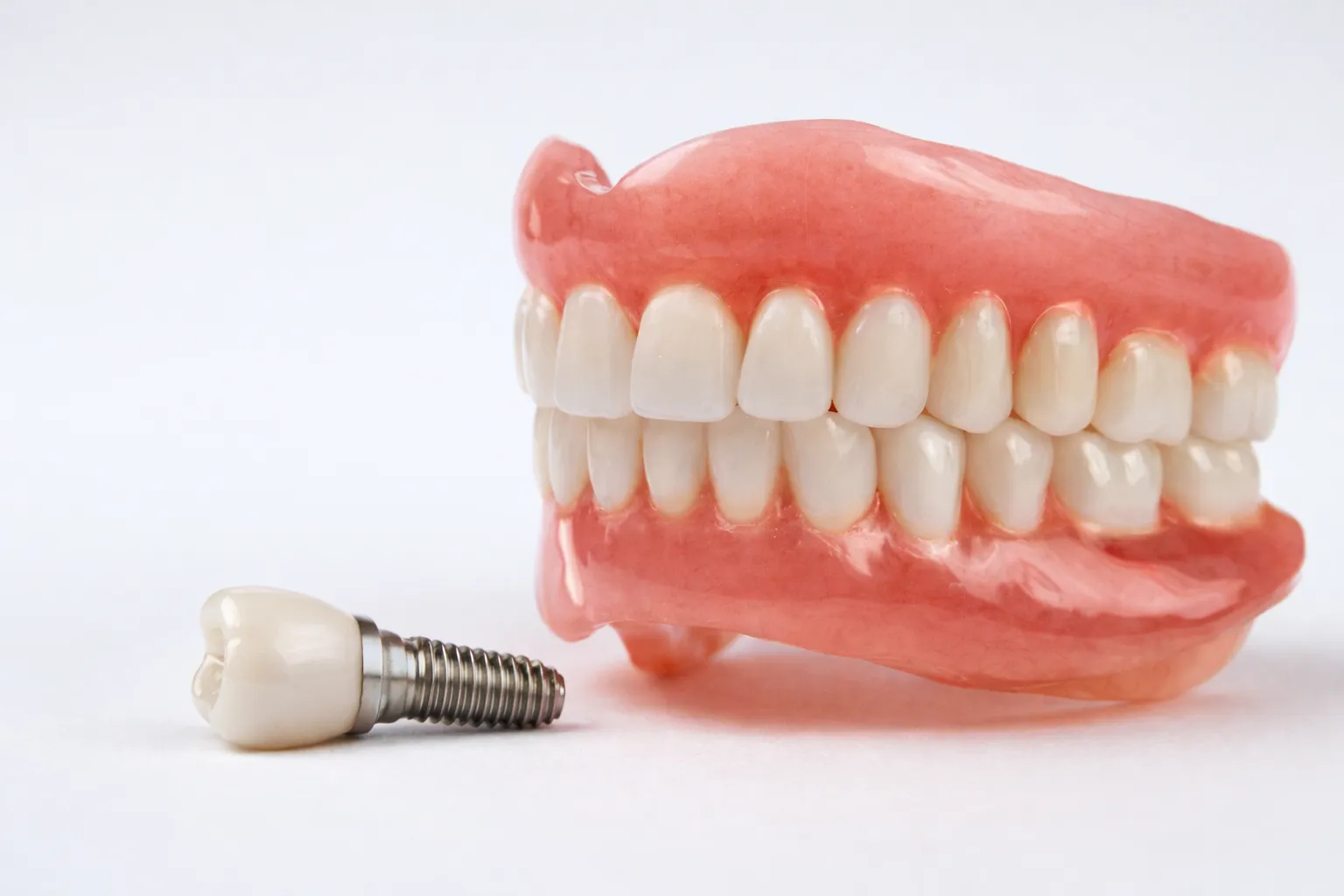 Is Implant or Prosthesis Better?